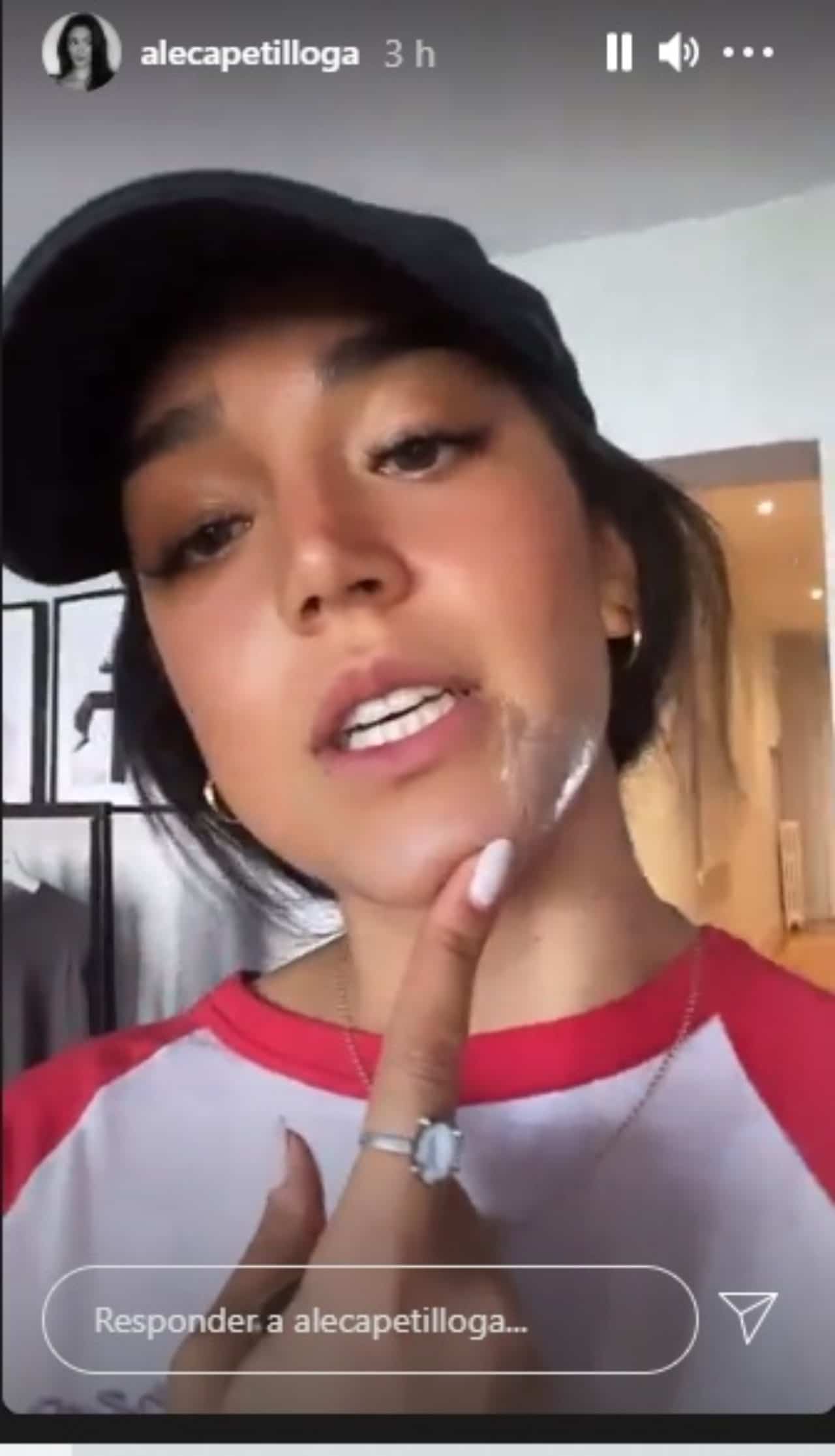 Hija Biby Gaytan Ale Capetillo quemadura
