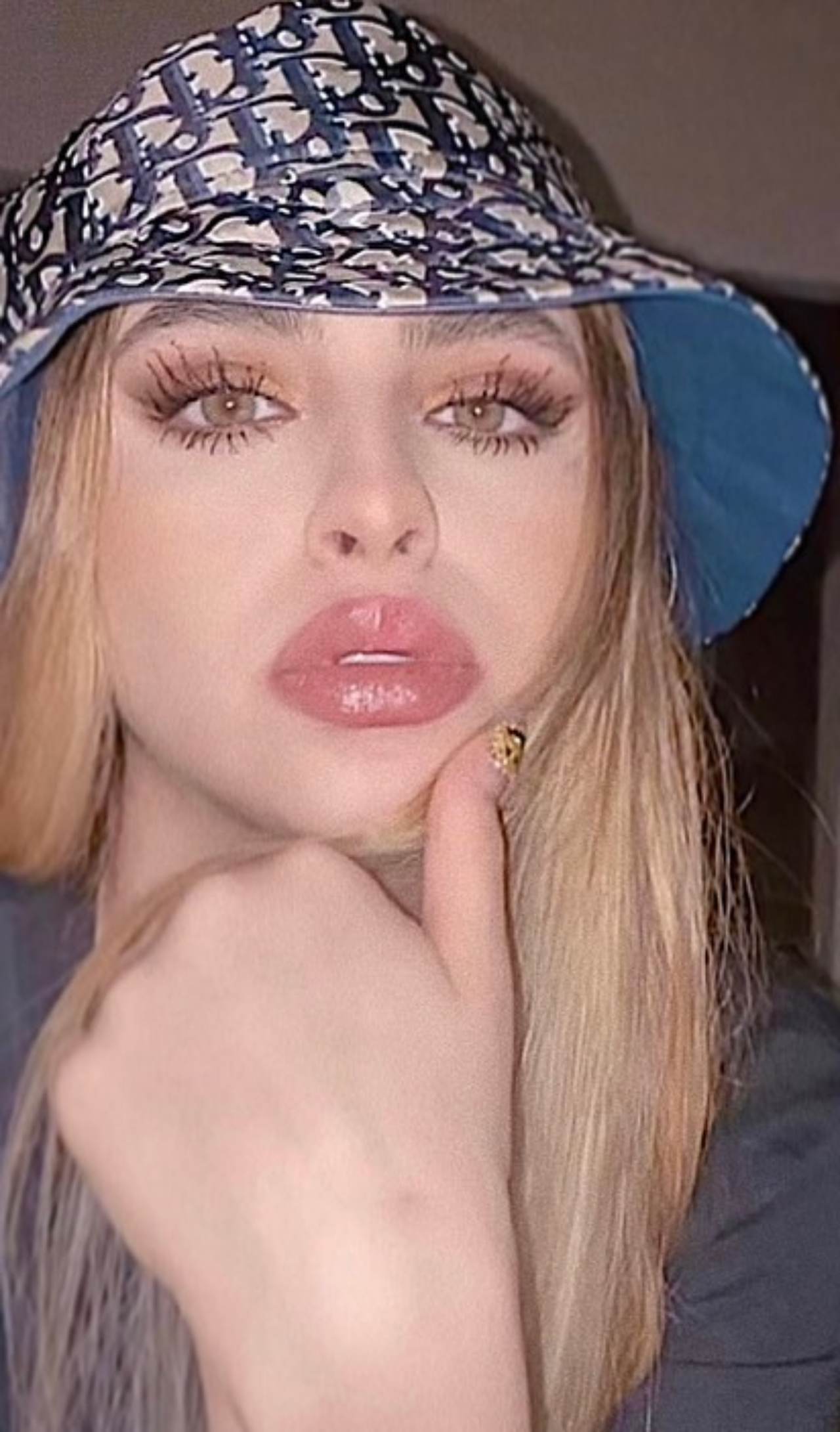 Amely hermana Nodal labios Kylie Jenner