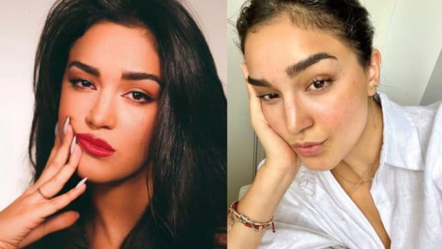 Hija Biby Gaytan quemadura aceite rostro