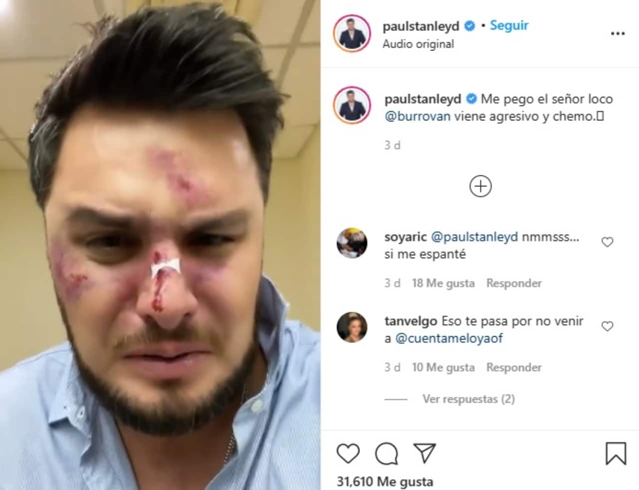 Paul Stanley Burro Van Rankin golpeado