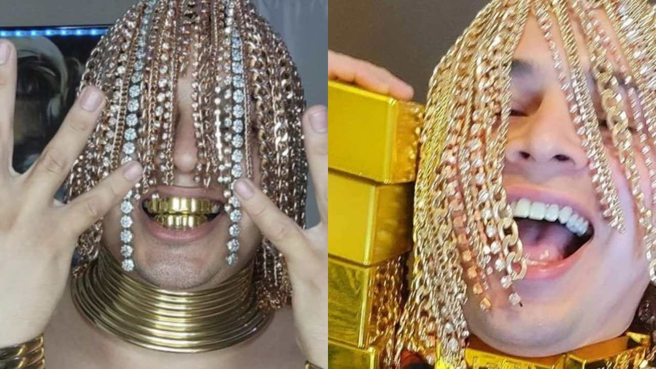 Rapero mexicano se implanta cadenas de oro como cabello