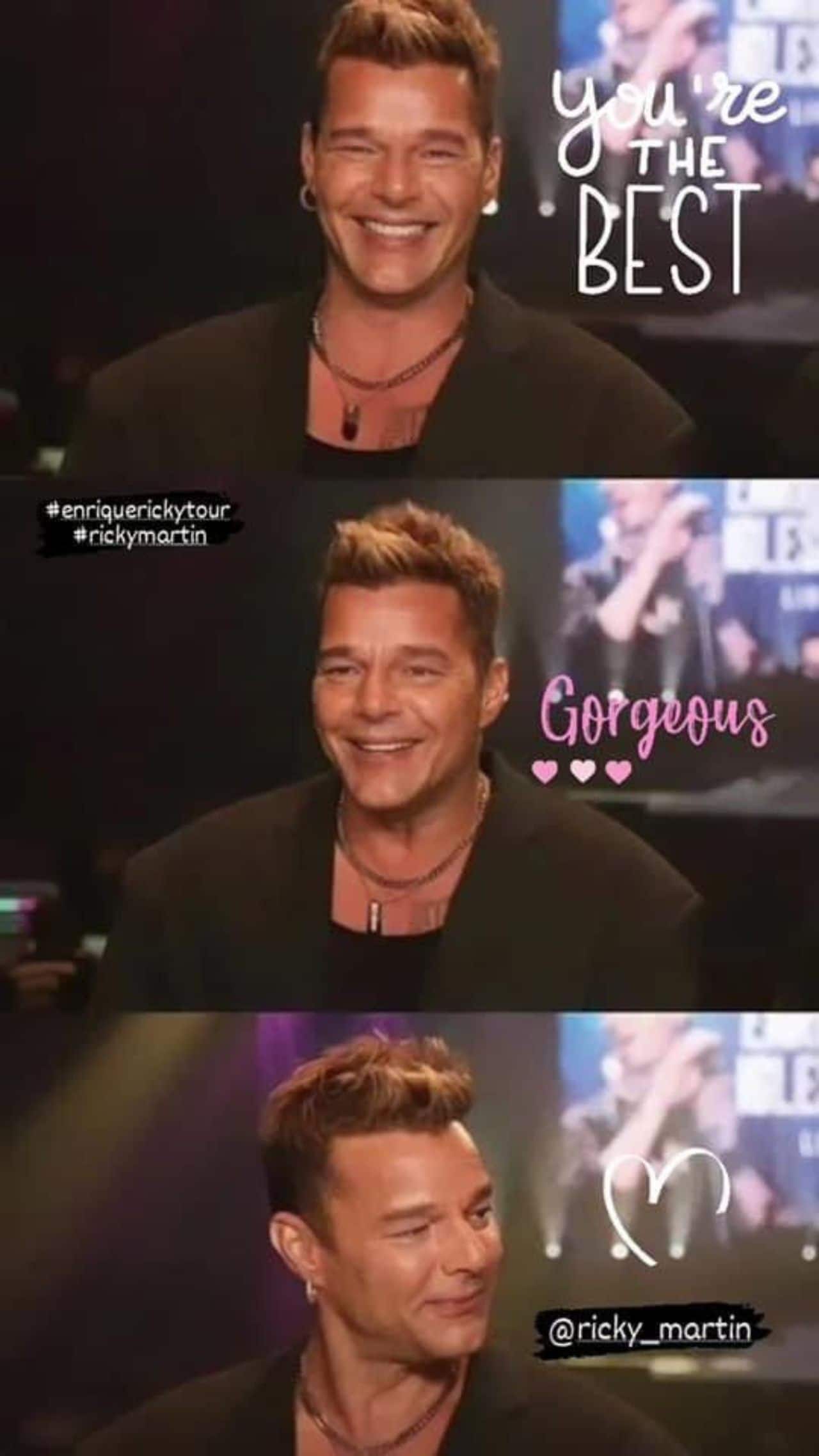 Ricky martin se pone botox cara