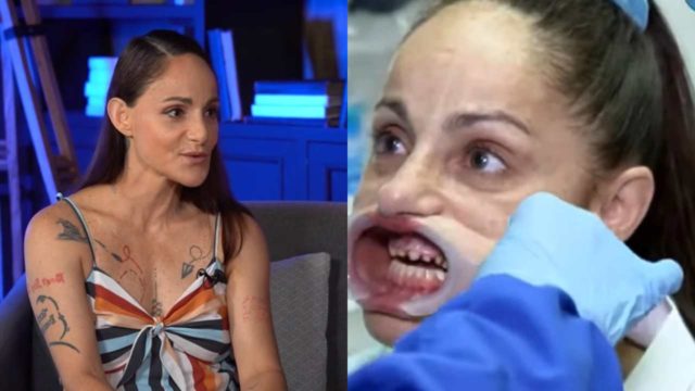 Lolita Cortés dientes