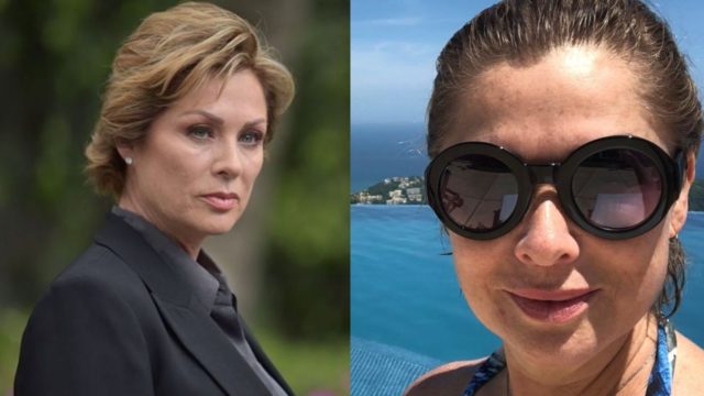 Leticia Calderon aprovecha hospitalizacion arreglos esteticos