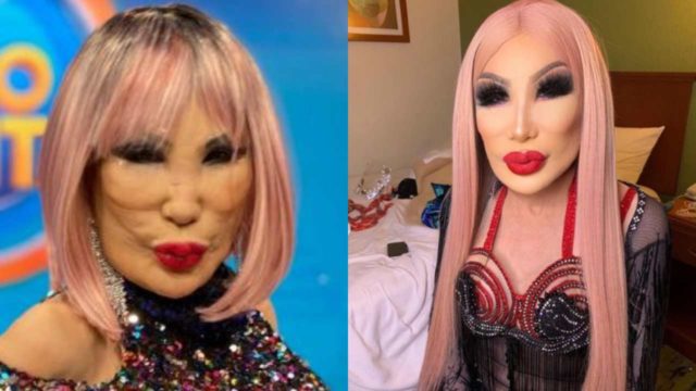 Lyn May se pone bótox y luce radical transformacion
