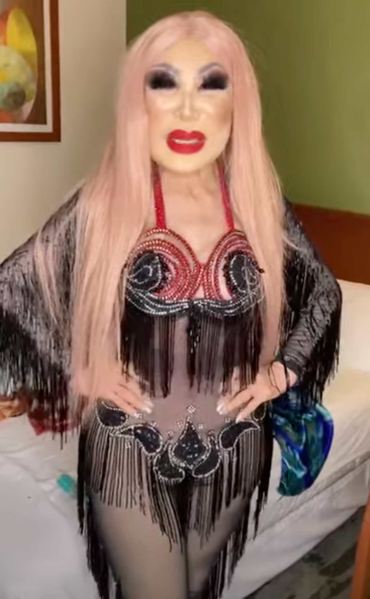 Lyn May se pone bótox
