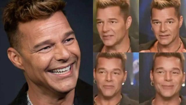 Aclaran qué pasó con el rostro hinchado de Ricky Martin