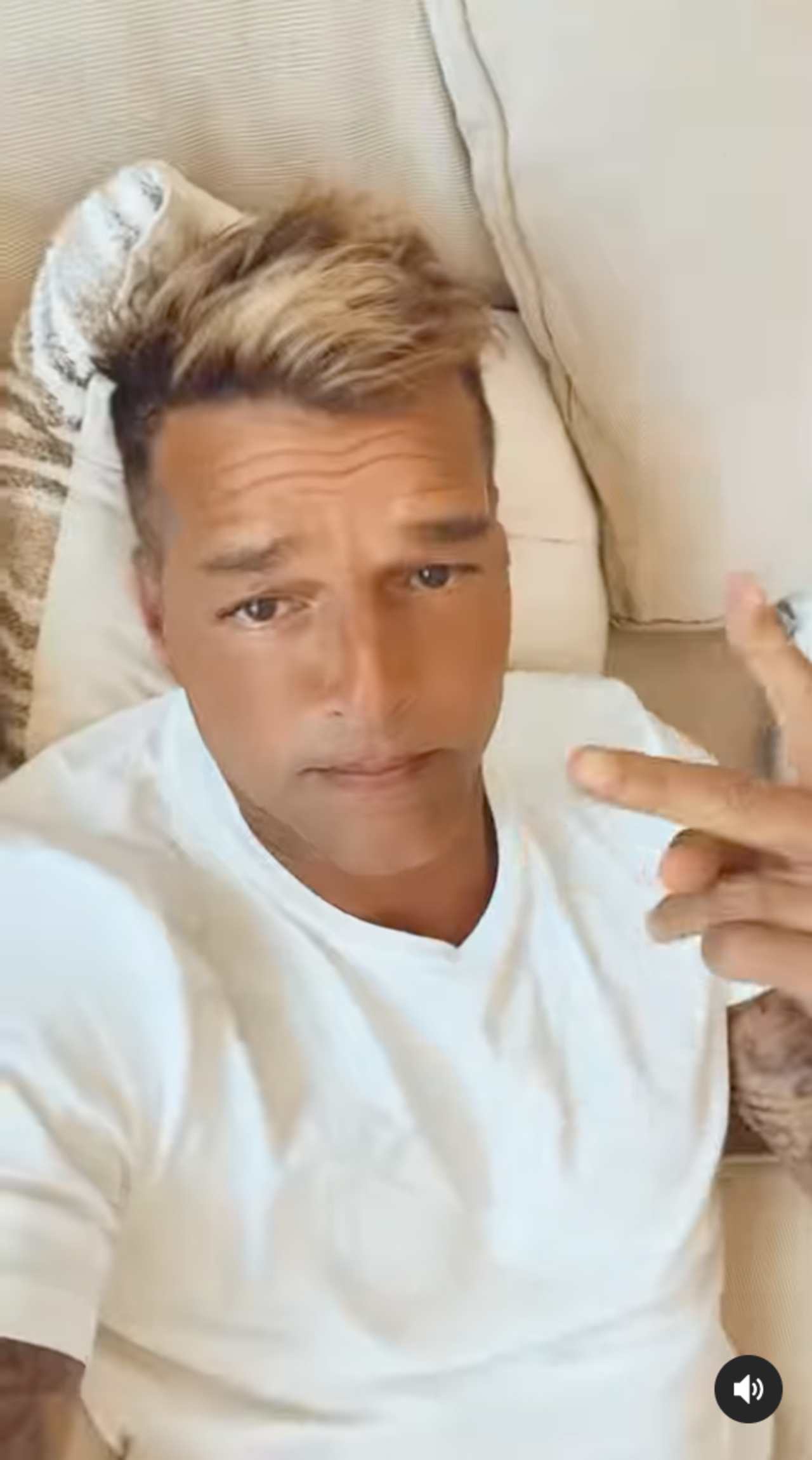 Rostro Ricky Martin qué le pasó