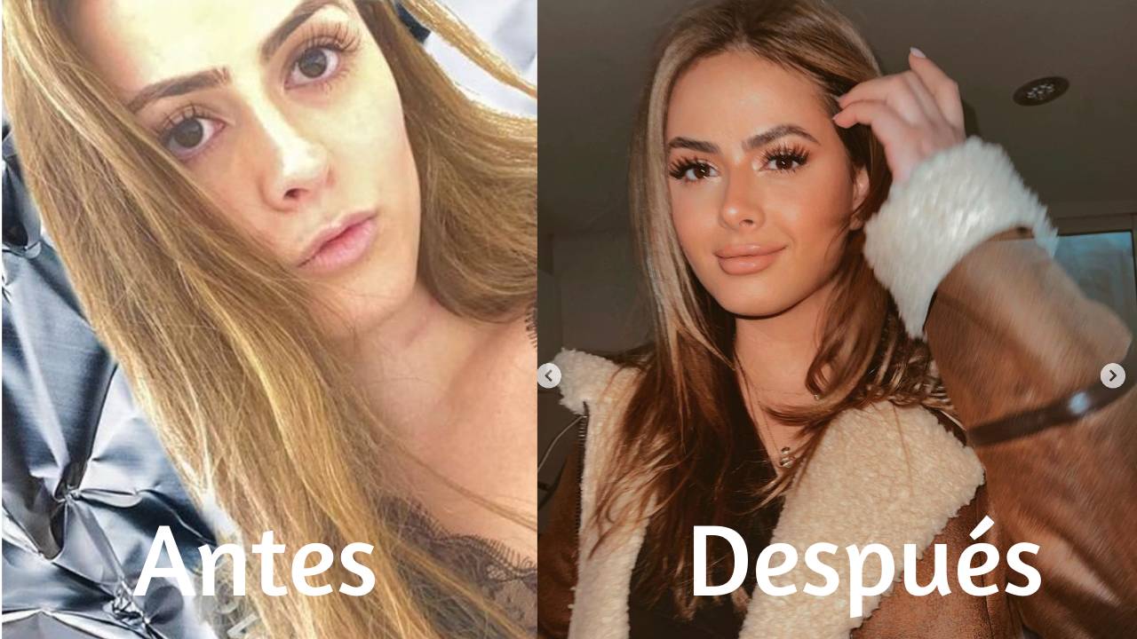 Hija Peña Nieto bótox ninel conde