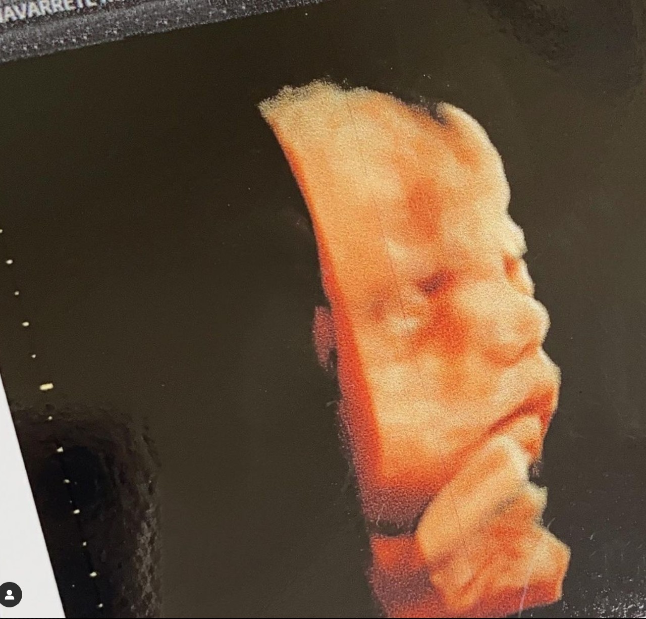 ultrasonido bebe ximena navarrete