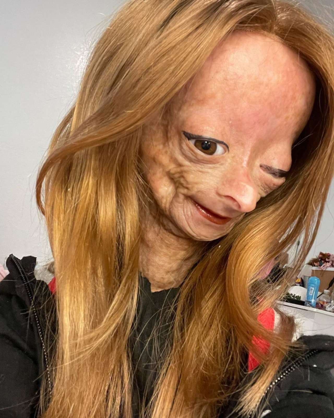 Muere Adalia Rose sindrome Muere Adalia Rose Williams a los 15 años por el síndrome Hutchinson Gilford
