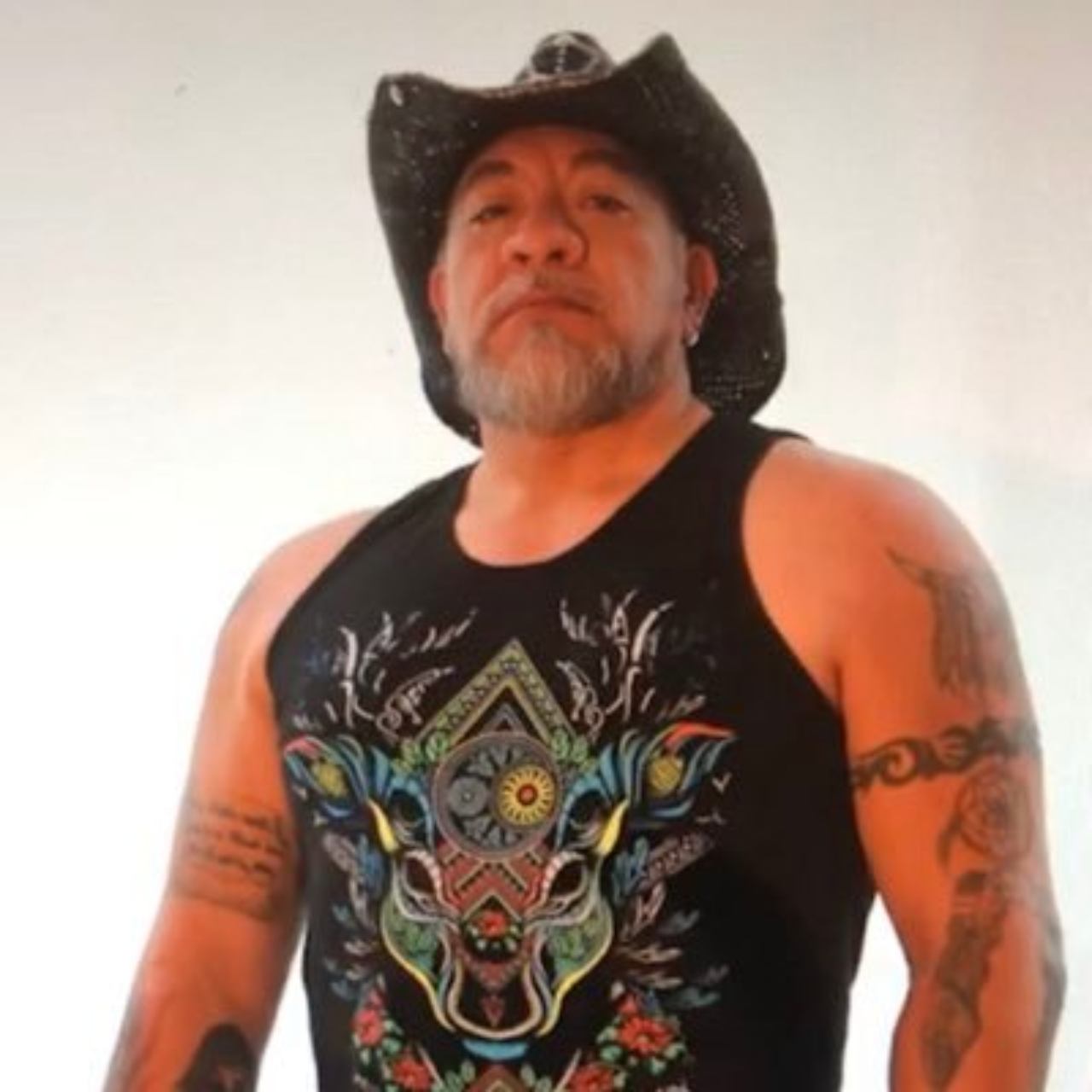 Carlos Trejo injerto cabello