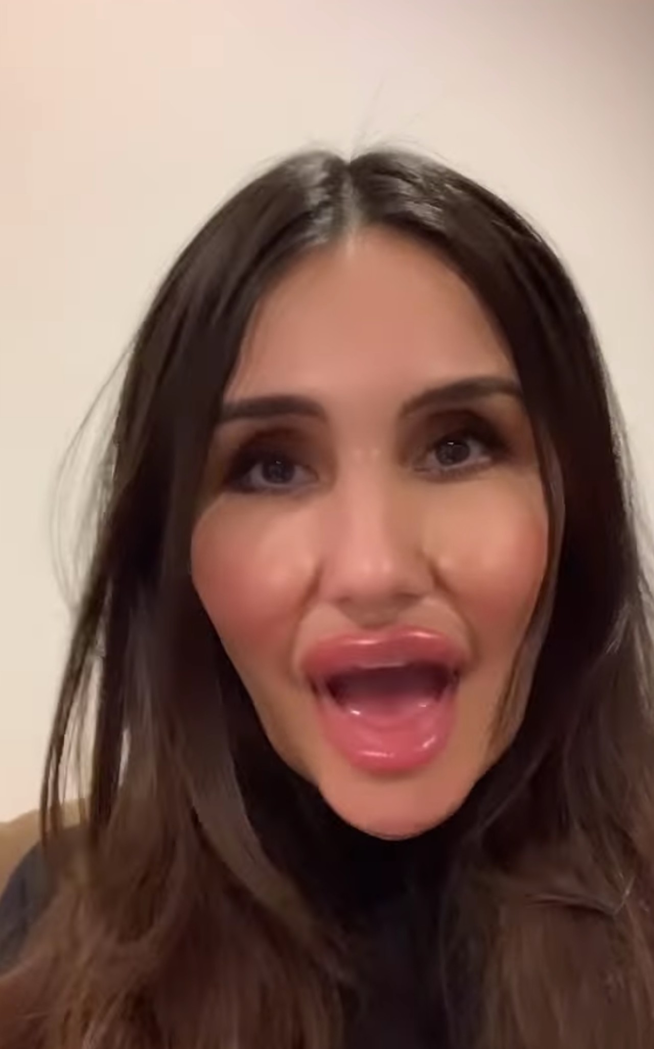 lyn may dulce maria cara transformacion