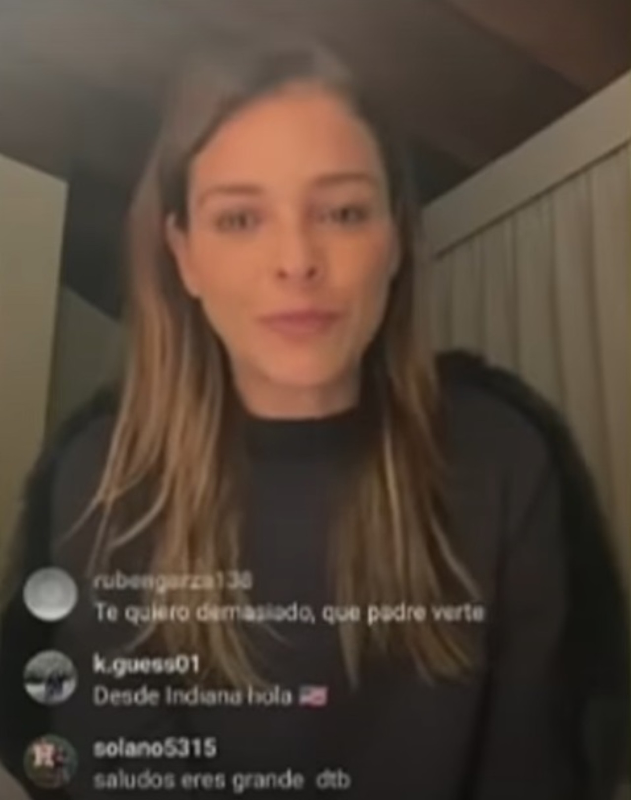 Grettell Valdez live Instagram dedo amputacion