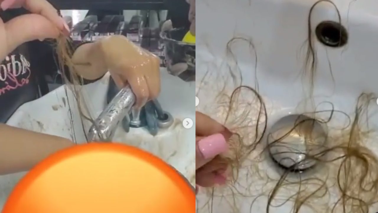Chica muestra quemaron pelo estetica Puebla