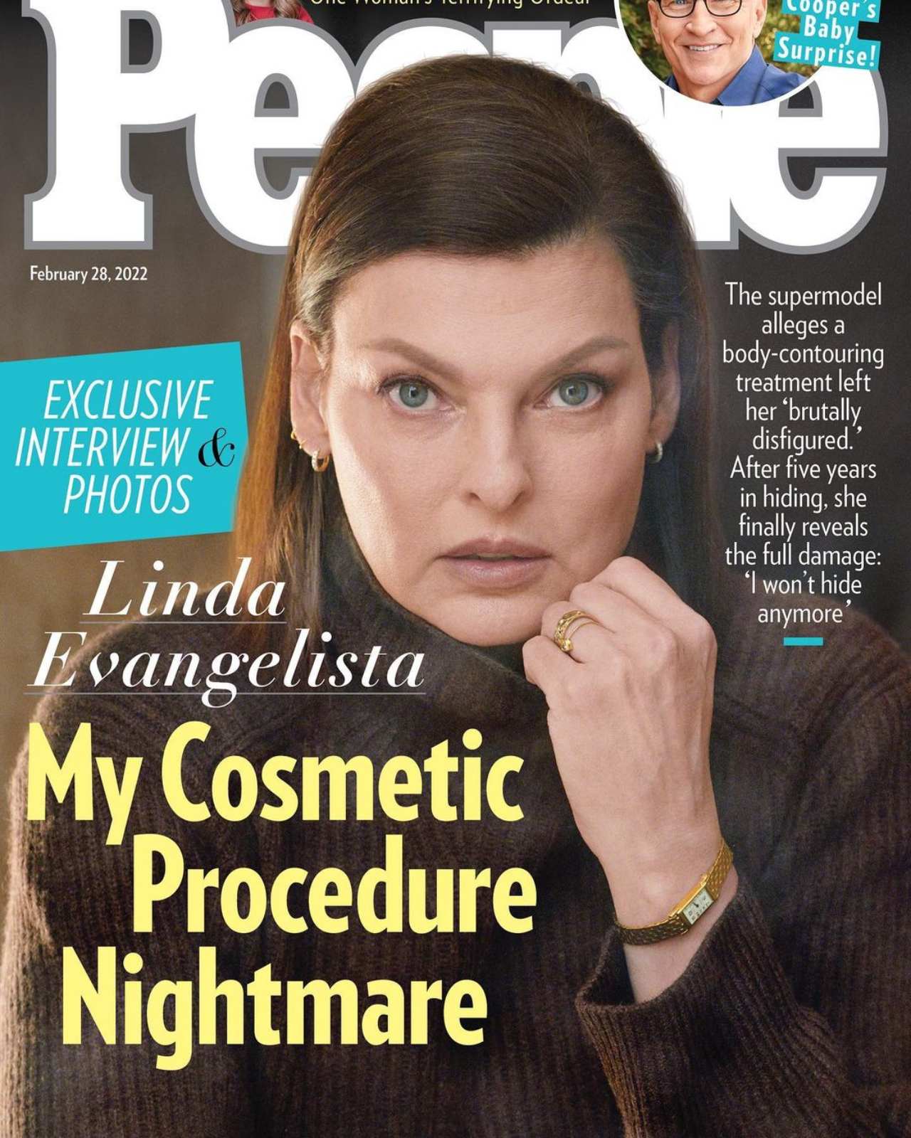 Linda Evangelista ahora 2022 rostro desfigurado