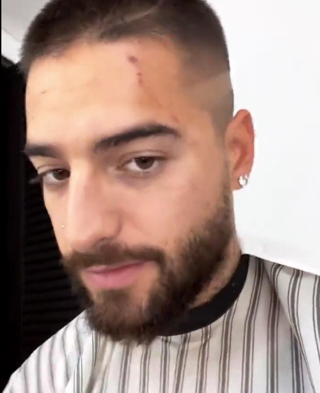 maluma perro mordida buda cara