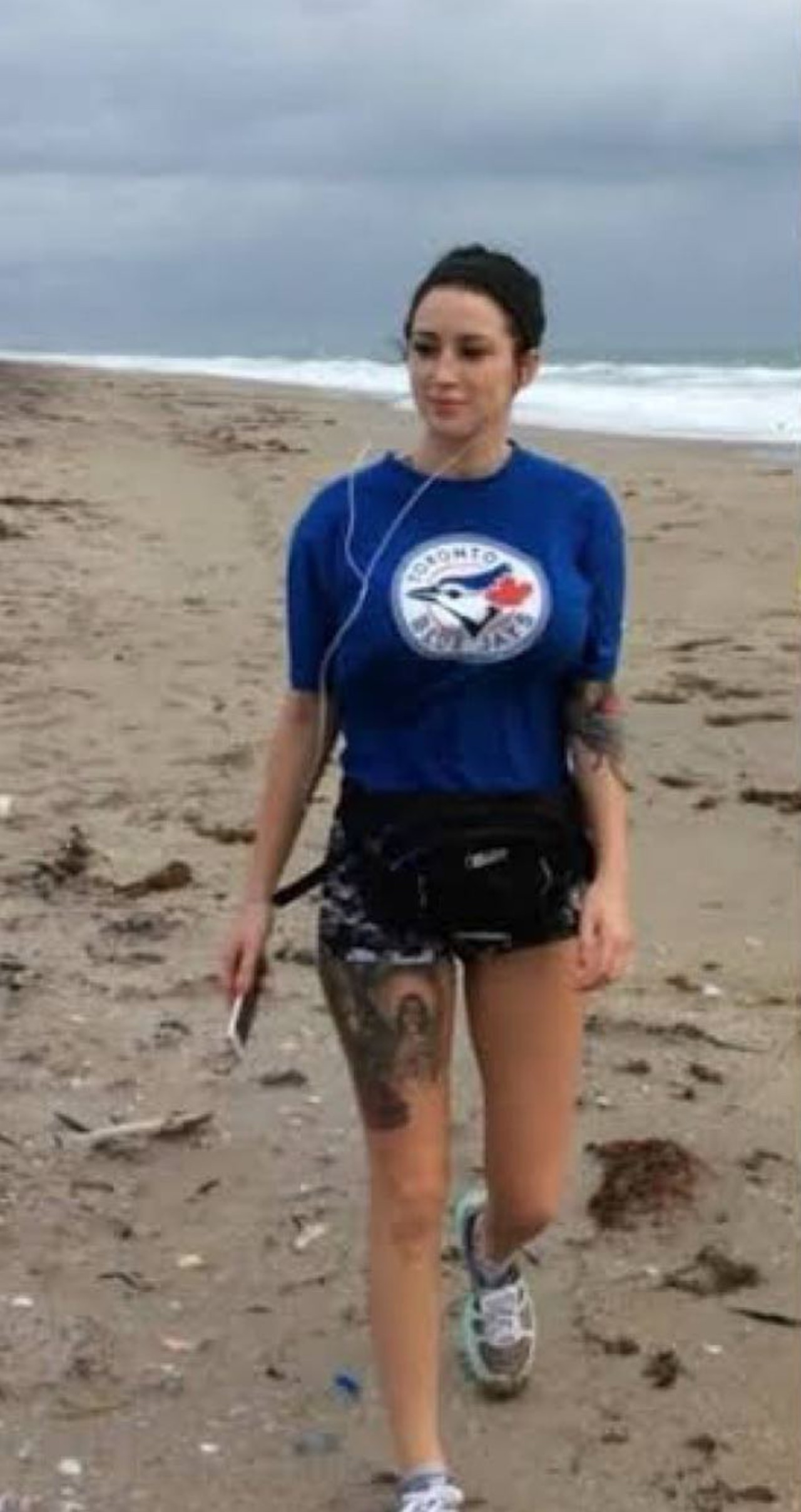 mujer canadiense antes de las cirugias