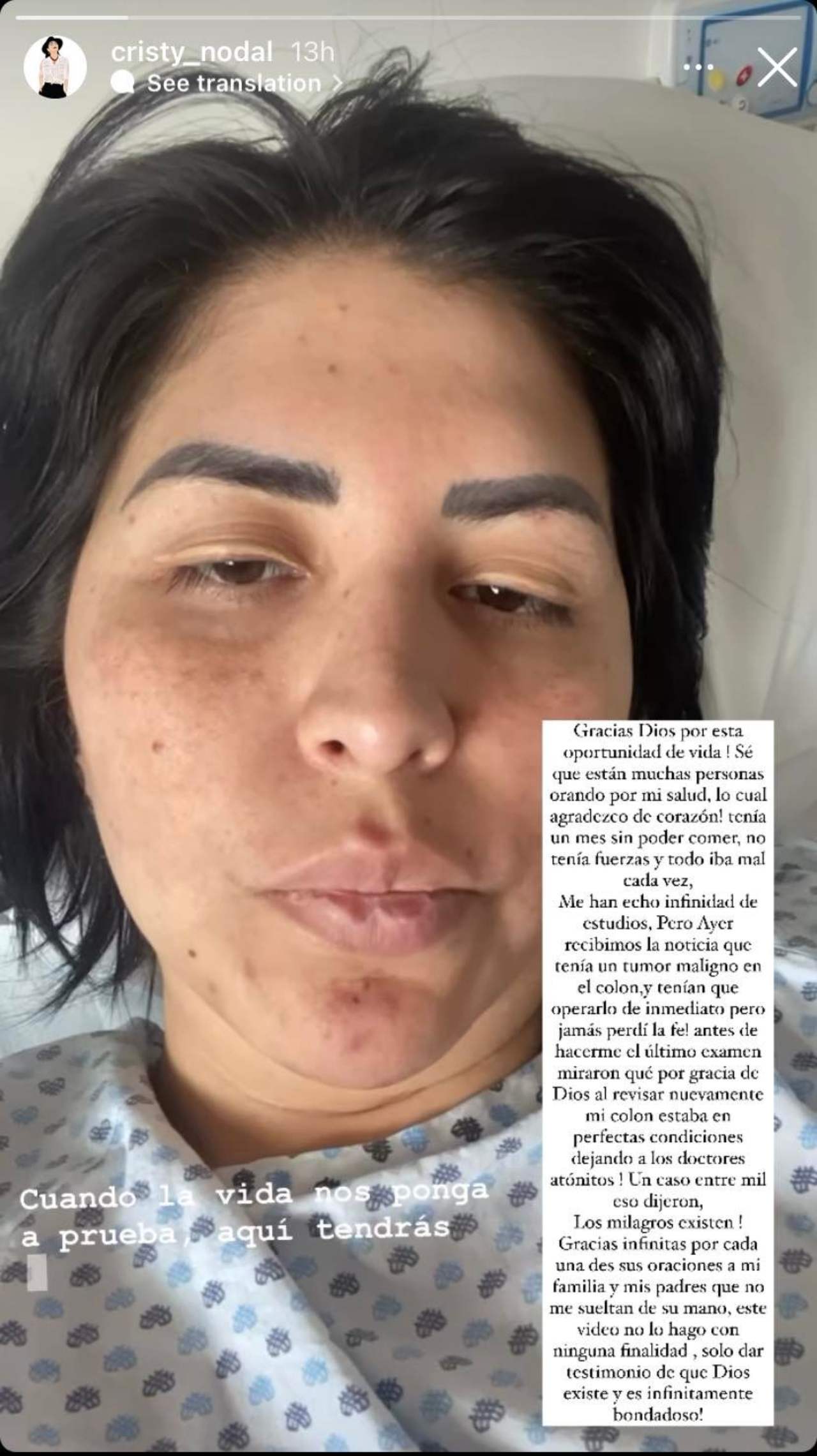 Cristy Nodal tumor maligno en colon