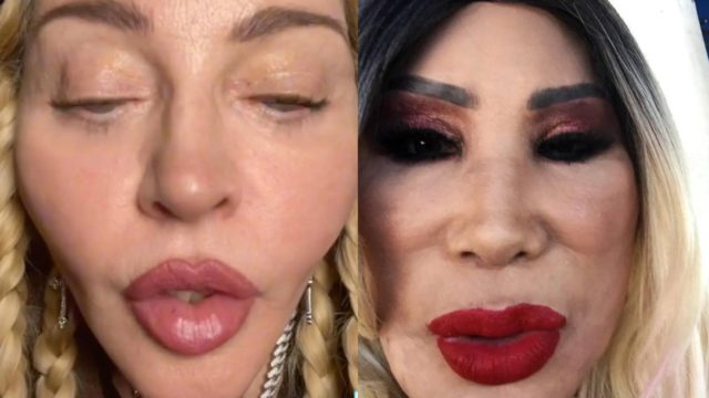 Madonna comparan Lyn May rostro inflado