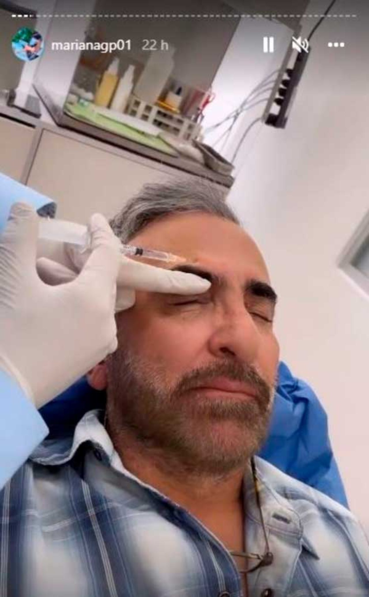 Vicente Fernandez Jr se inyecta botox joven