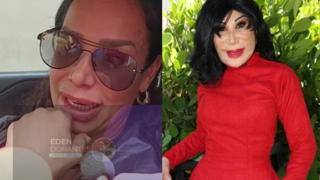 Comparaciones lyn may lis vega