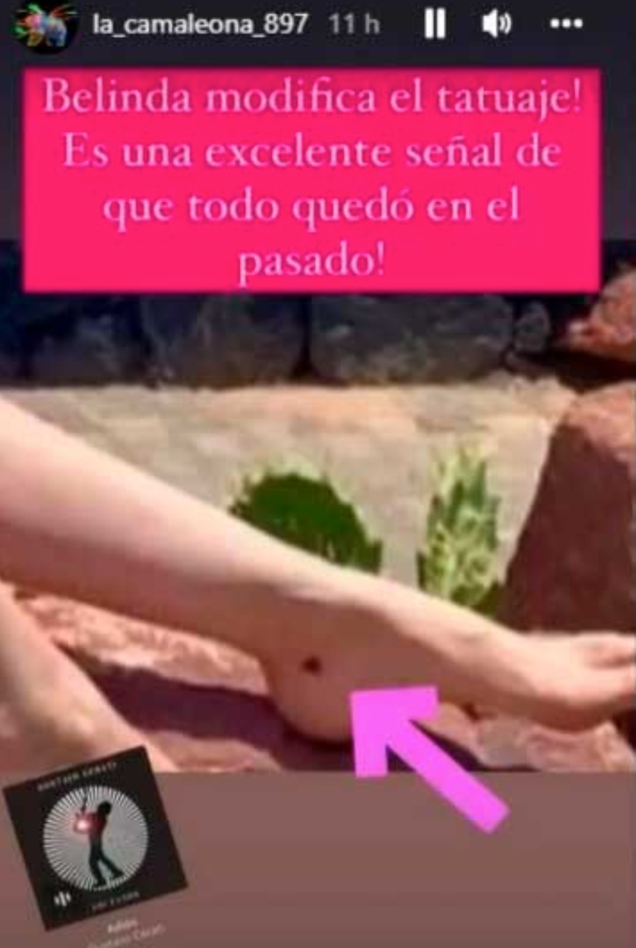 Belinda tatuaje nodal borrado tobillo