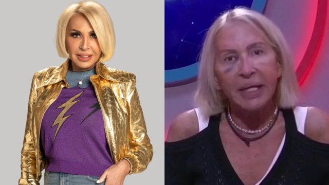 Razon Laura Bozzo ojo morado actividad