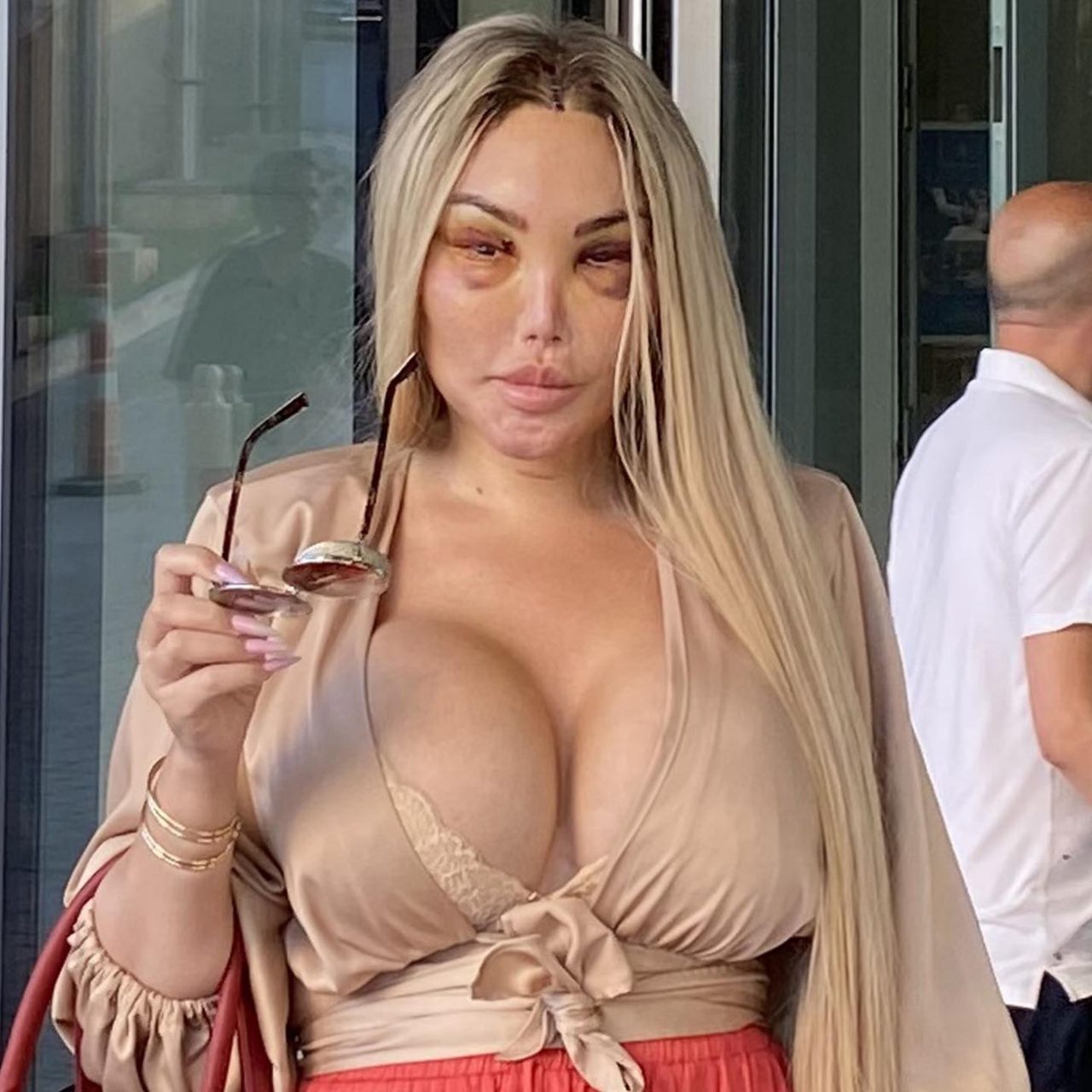 barbie humana Jessica Alves moretones cara