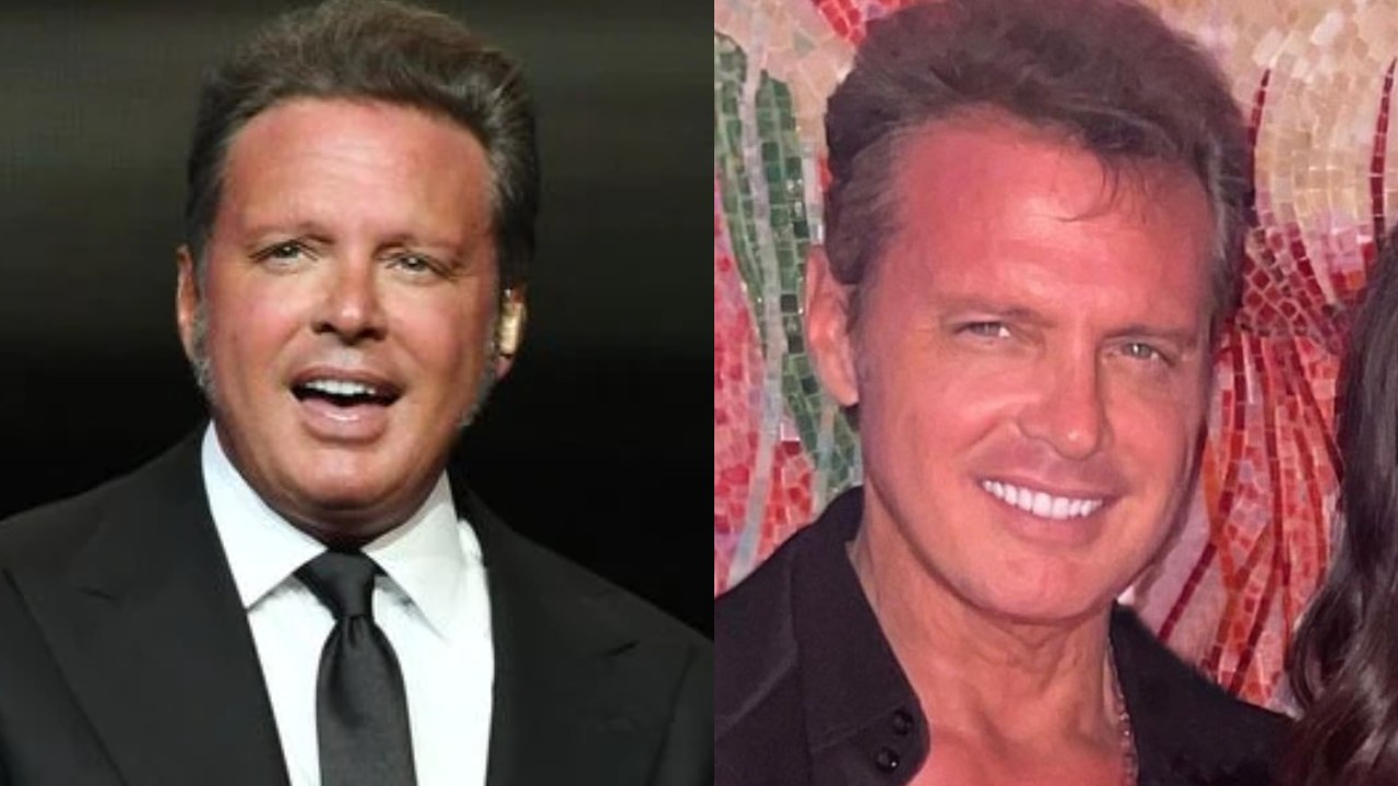Luis Miguel cirugias para verse joven