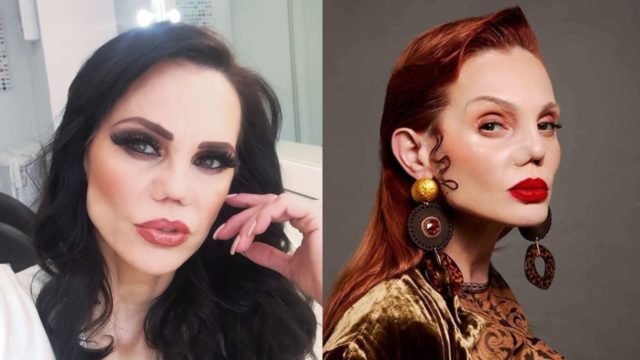 Antes y despues Carmen Campuzano nariz