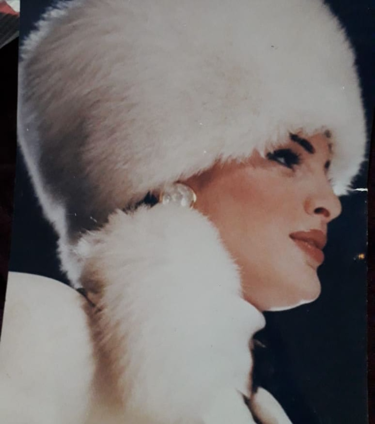 Carmen Campuzano antes de operarse nariz
