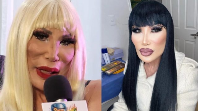 Lyn May joven rostro operada