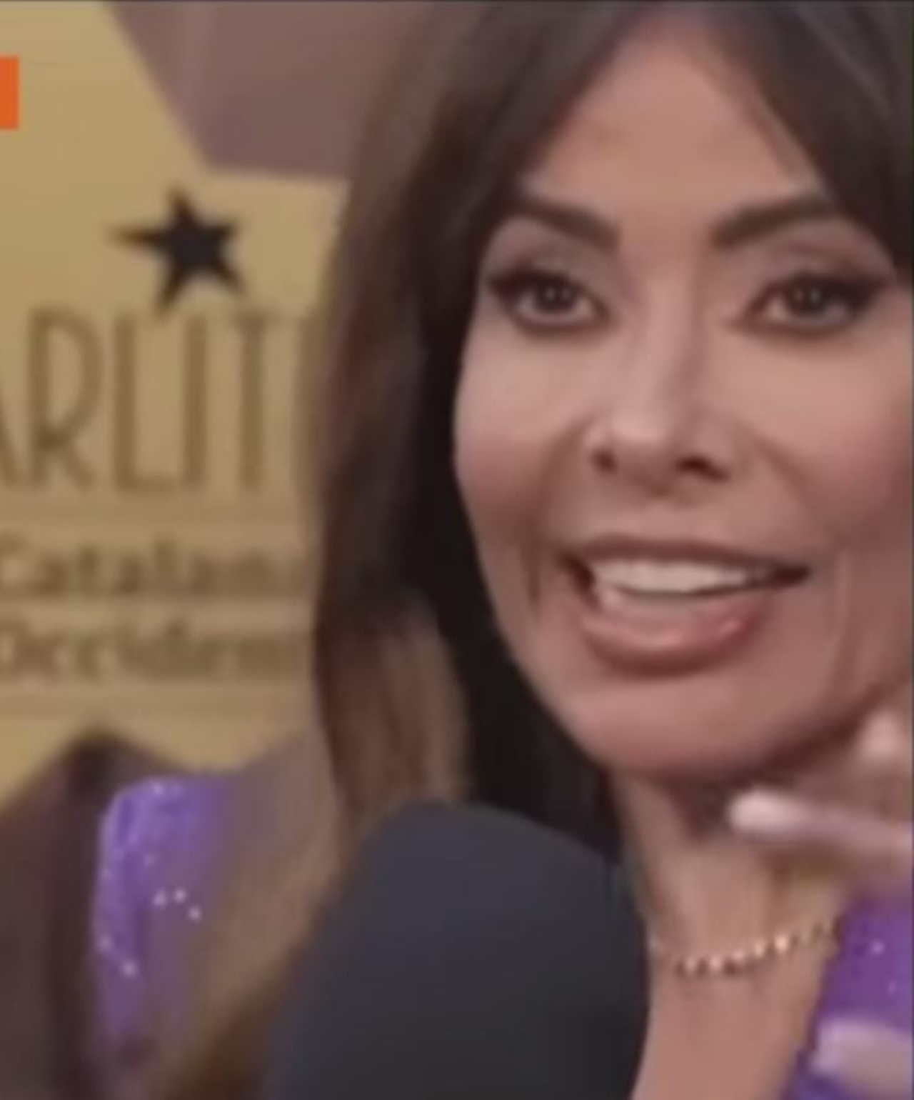 Gloria Trevi cara jalada