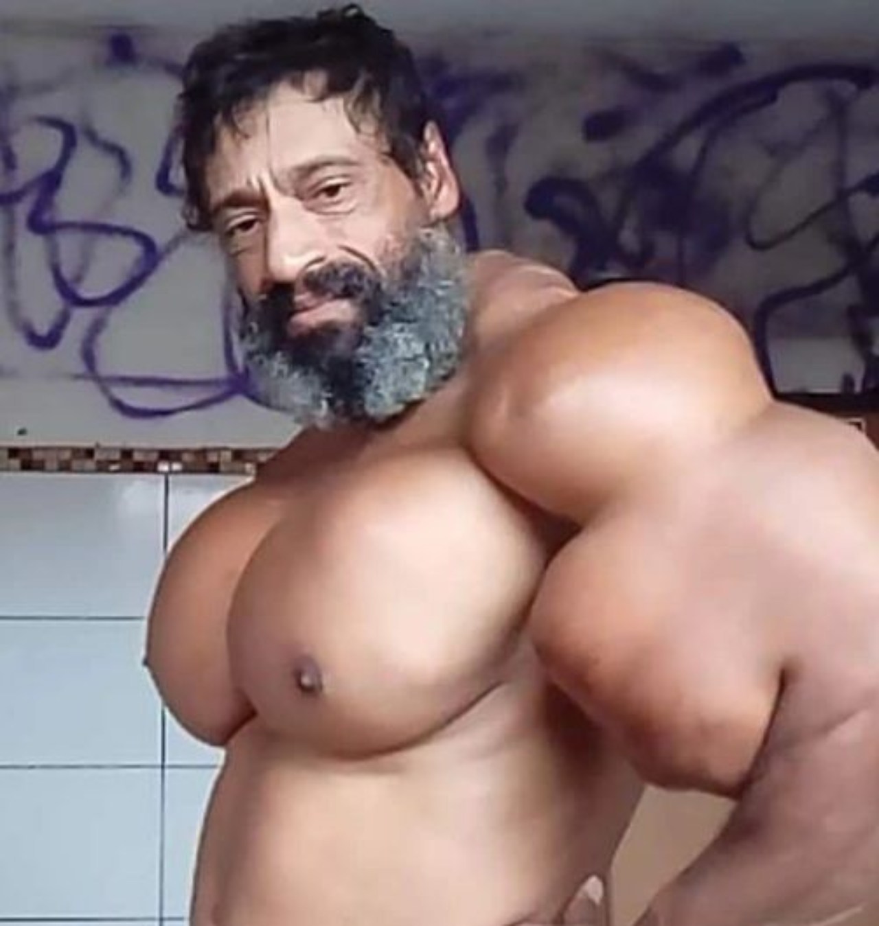 Hulk brasileño muere tras inyectarse biceps