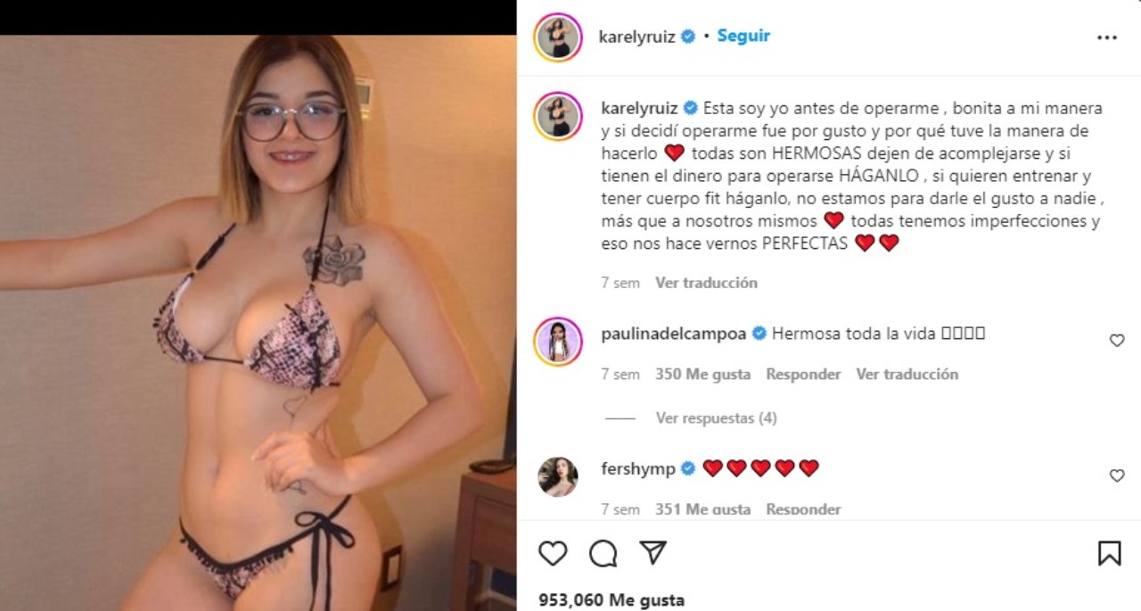 Karely Ruiza antes de sus cirugias
