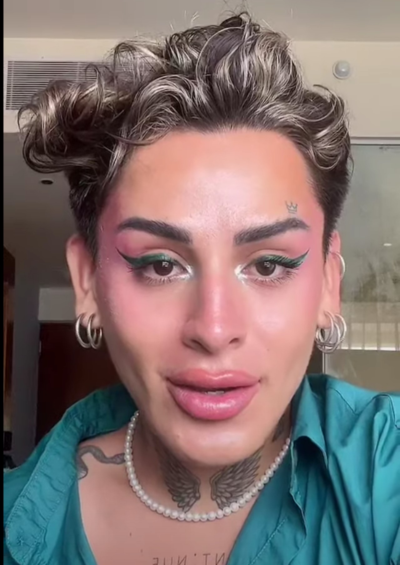 Kunno rostro arreglo botox operacion