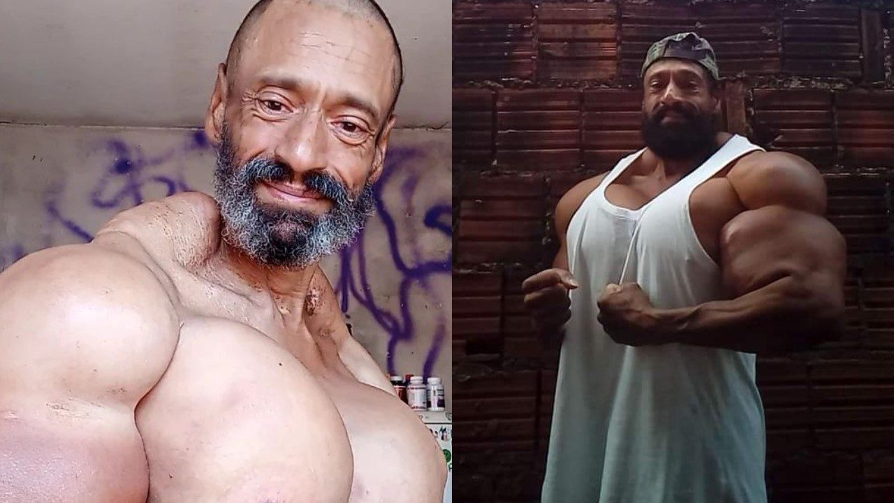 Hulk brasileño muere Valdir Segato inyectarse