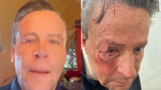 Alfredo Adame golpeado brutalmente afuera casa