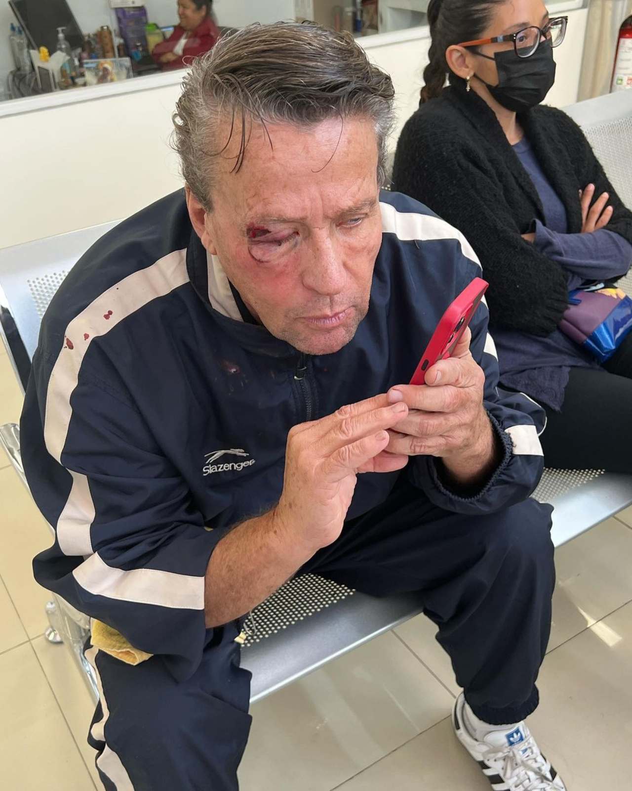 Alfredo Adame golpeado afuera casa ojo