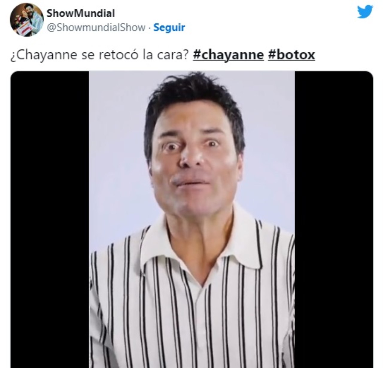 Aseguran Chayanne se puso botox cara