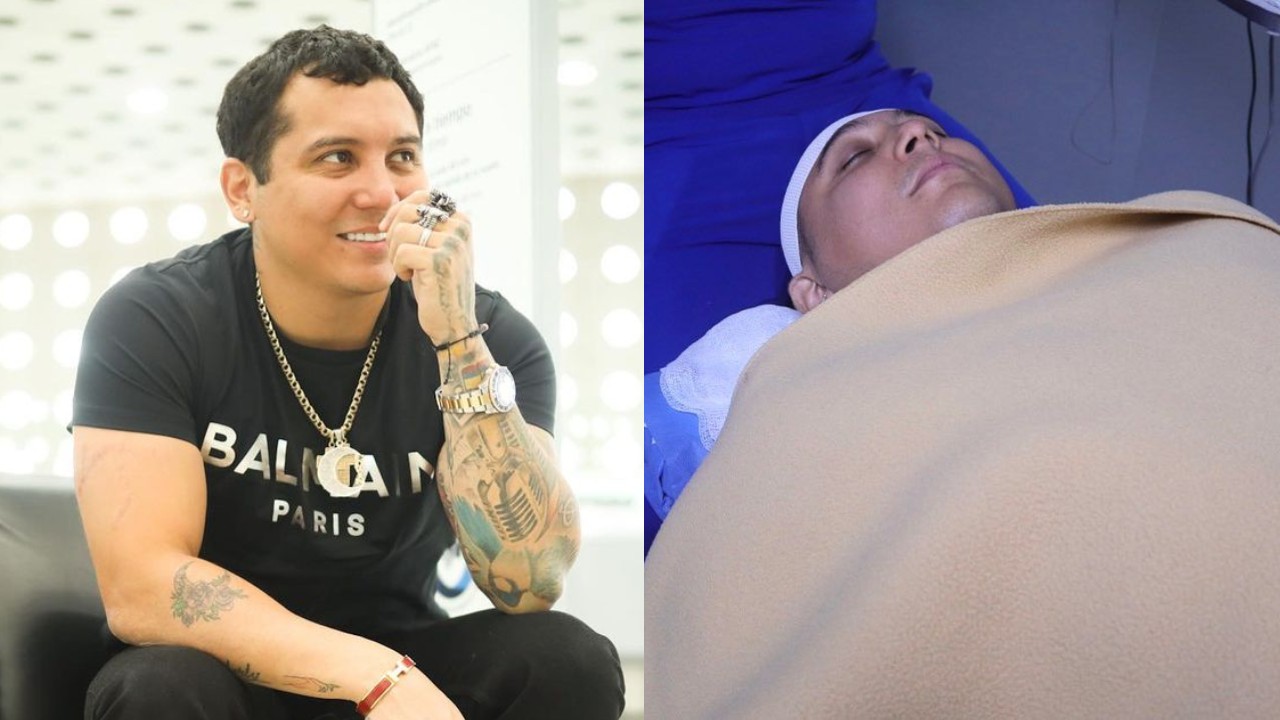 Edwin Luna se somete a tratamiento capilar