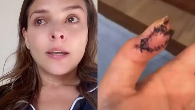 Grettel amputación cáncer