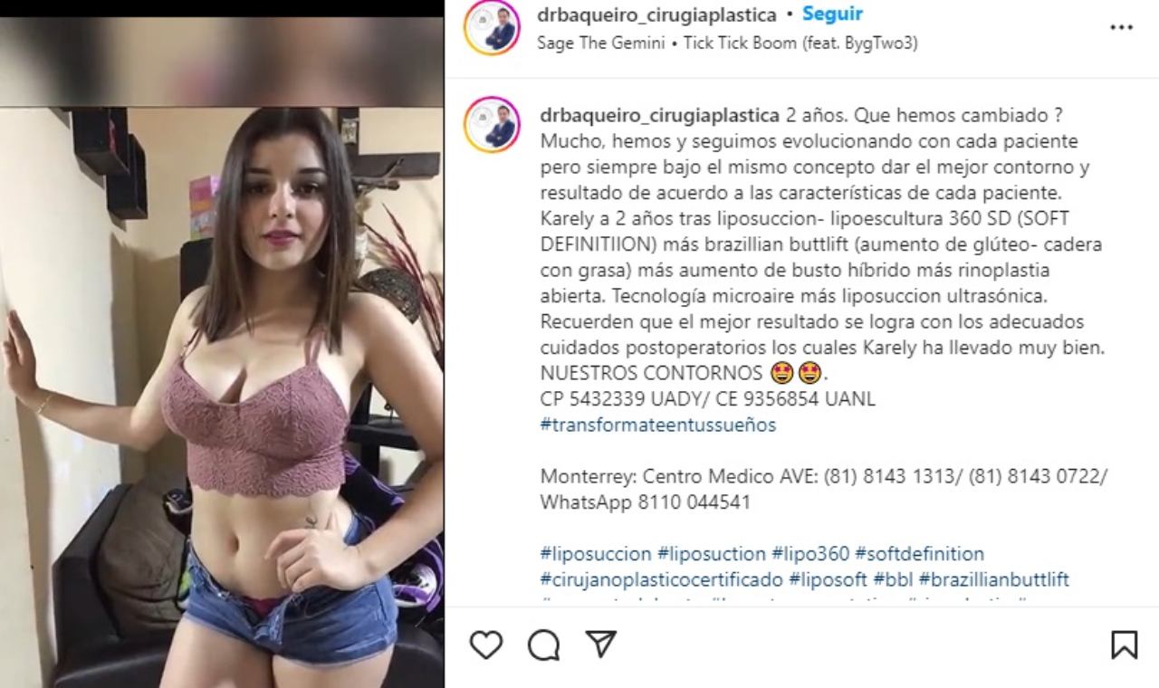 Cirujano revela cirugias de Karely Ruiz
