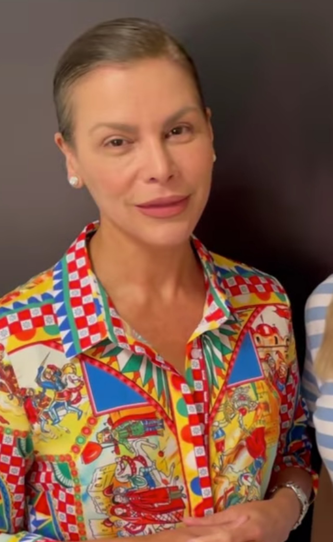Olga Tañón cirugía en colombia cantante