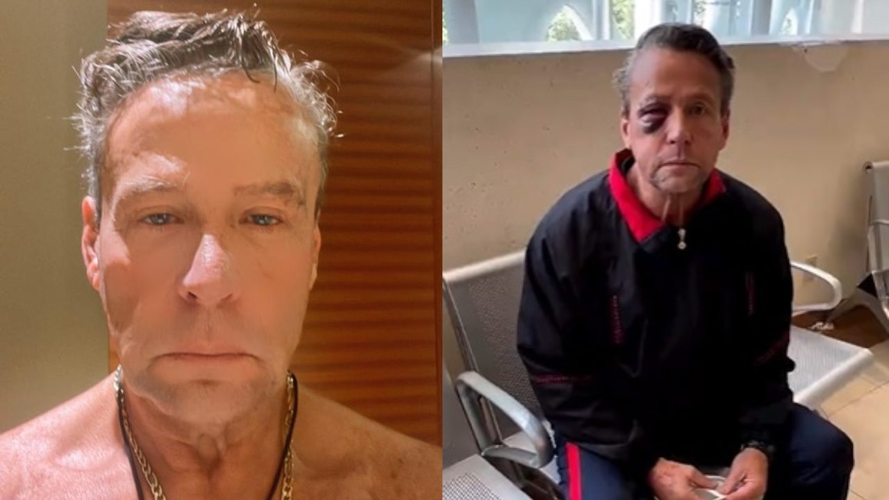Alfredo Adame hospitalizado de emergencia cirugia