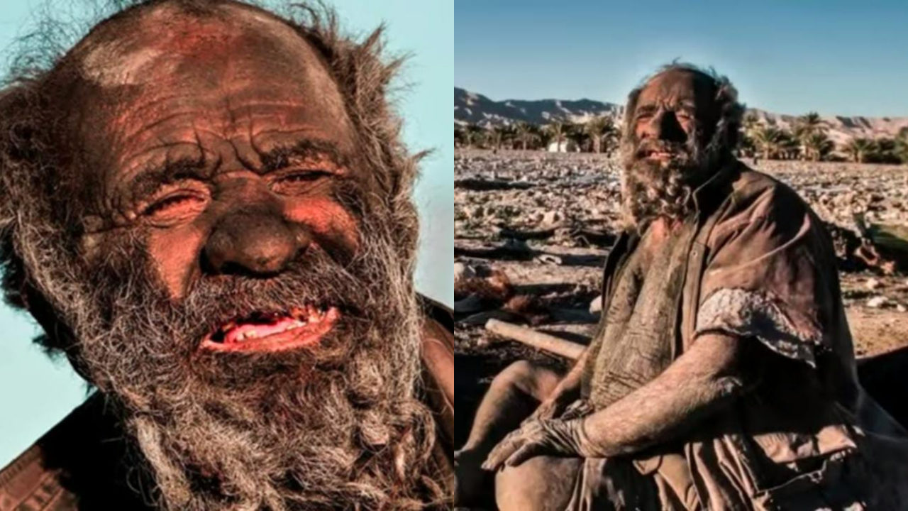 Muere hombre más sucio mundo