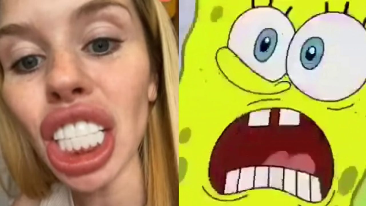 Mujer blanqueamiento dental parece un caballo