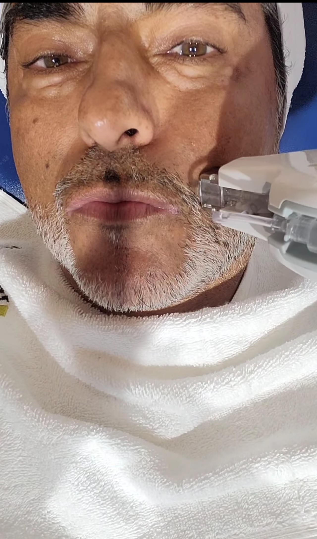 Raúl Araiza cara arreglitos esteticos nuevo