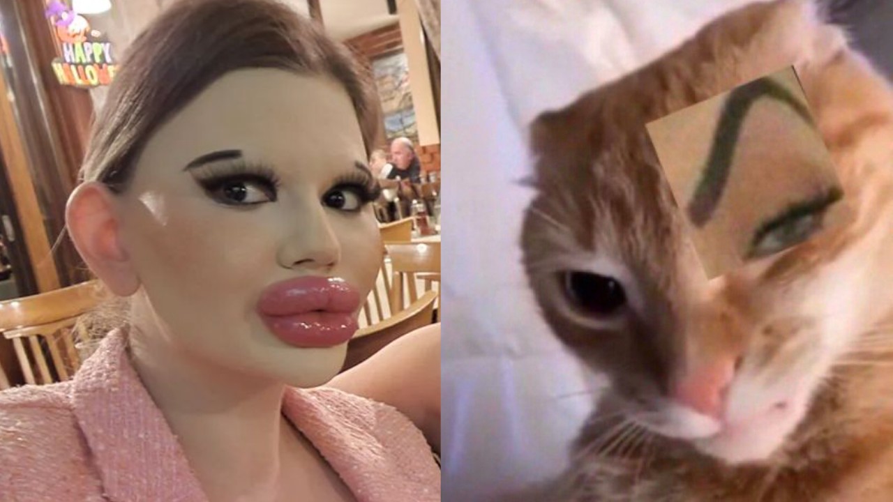 influencer cirugÃ­a estÃ©tica labios esteticas